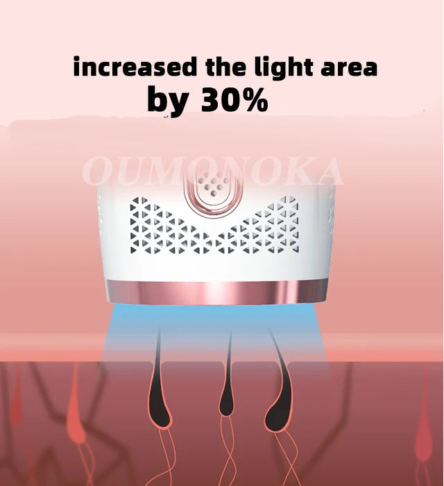 Hair Removal laser